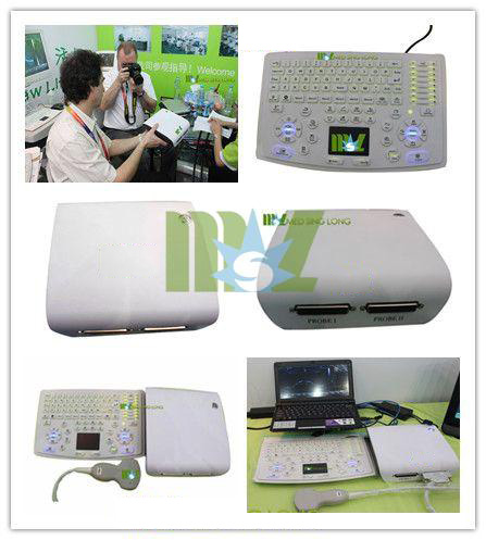 Portable Ultrasound scanner box & ultrasound box for sale-MSLPU15