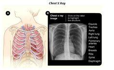 High frequency x-ray radiograph unit