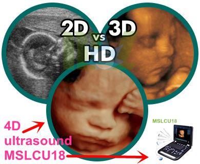 2D/3D/4D ultrasound machine comparison chart