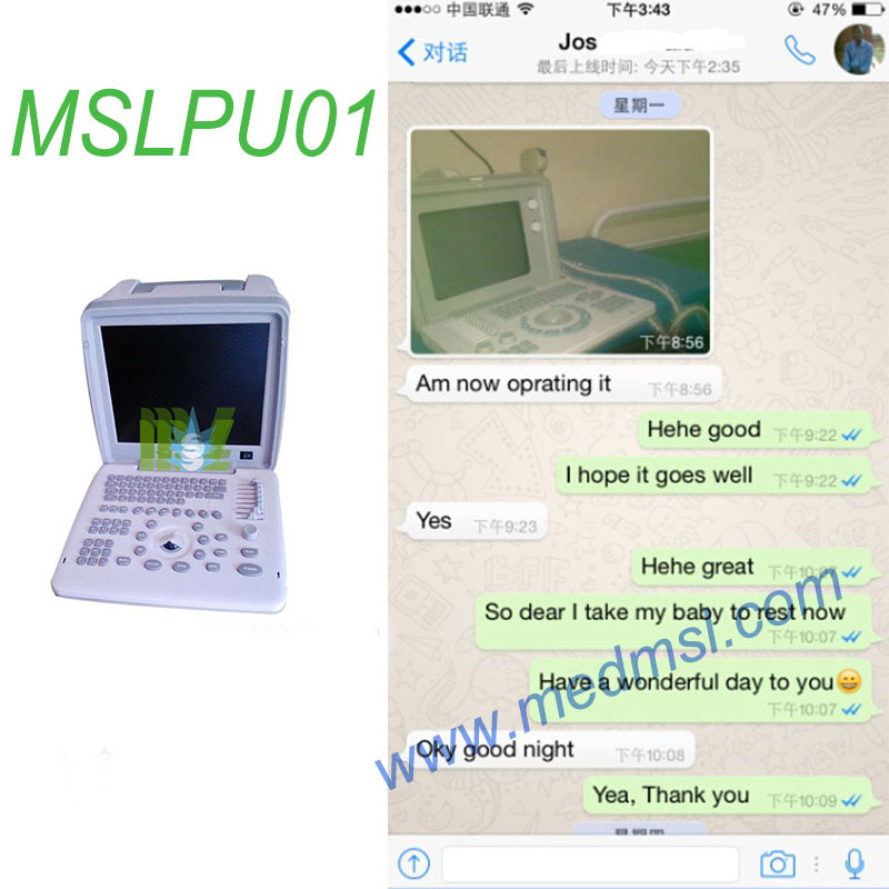 Portable ultrasound machine MSLPU01 Praises From Clients