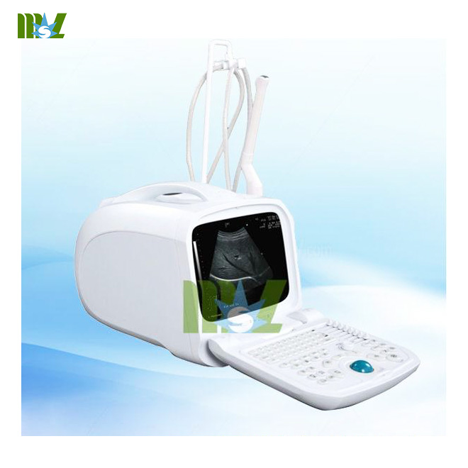 3D Ultrasounds
