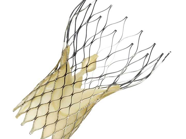 TAVR Durability Drama Likely to Persist