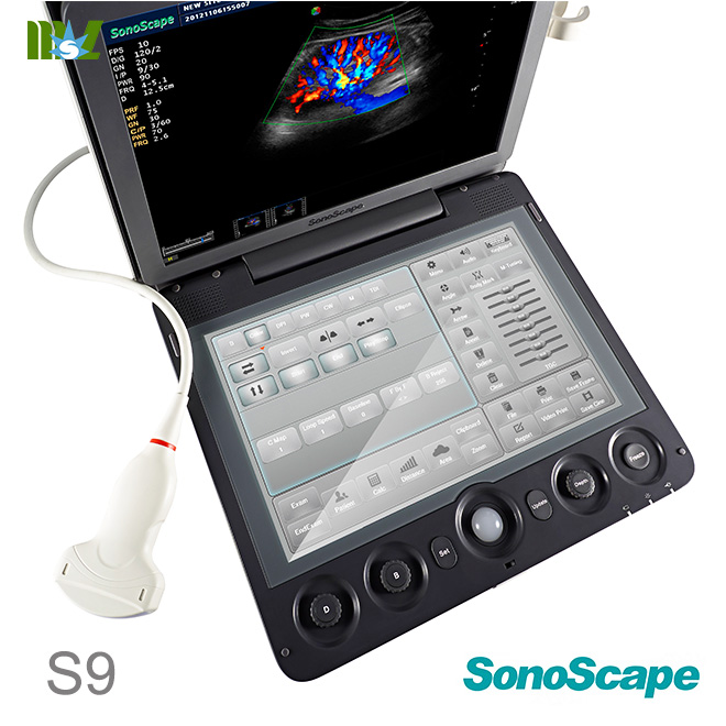 ecografie transfontanelara SonoScape S9 | ecografie doppler