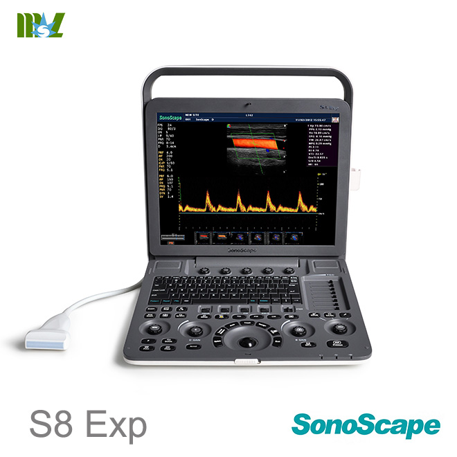 Factory direct sales best sonoscape ultrasound machine S8EXP