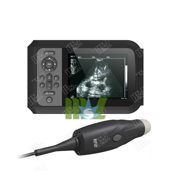 mini Ultrasound