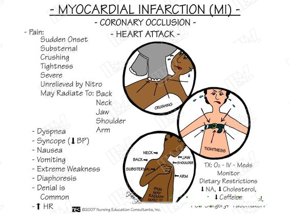 Acute Myocardial Infarction