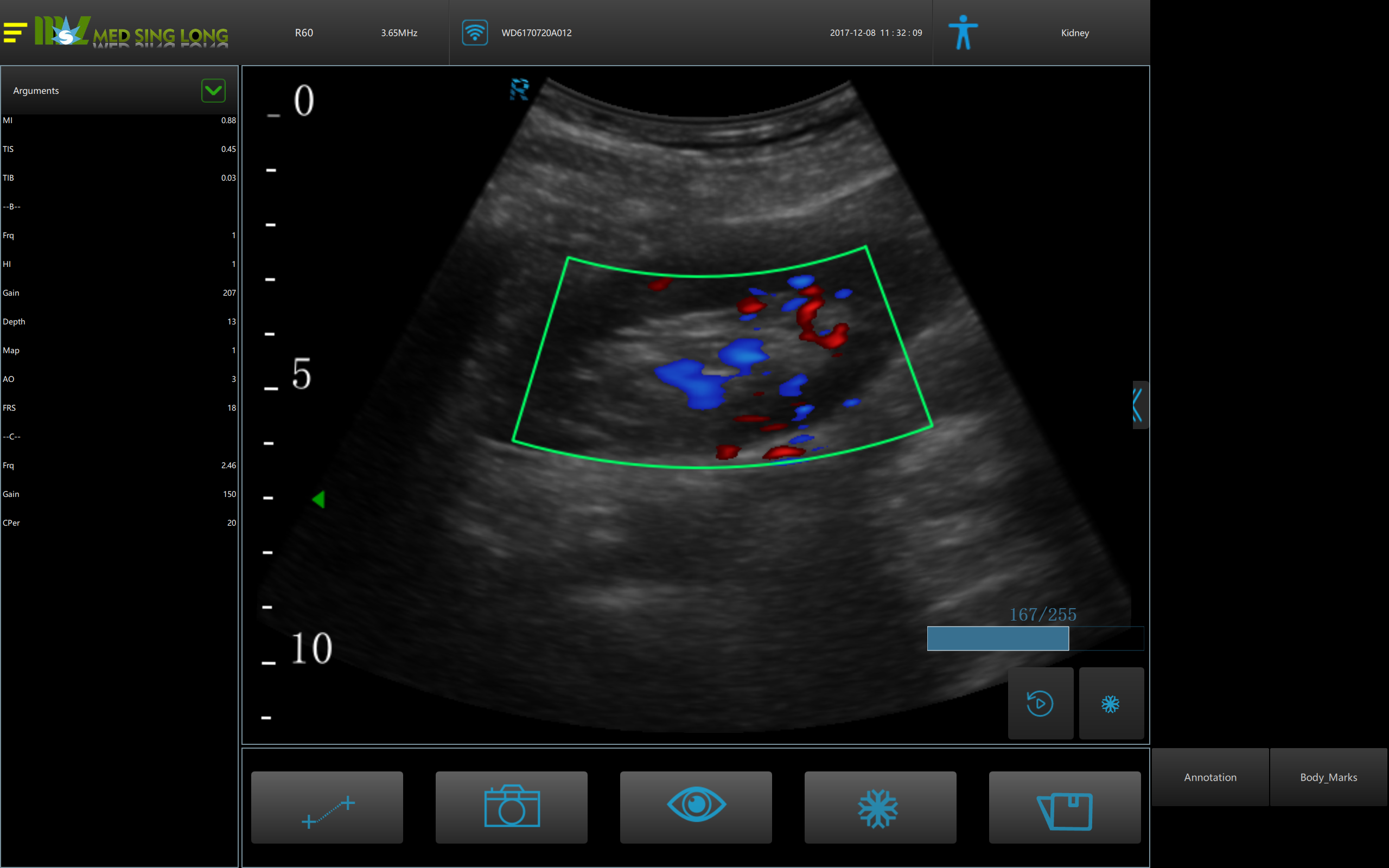 3D doppler ultrasound