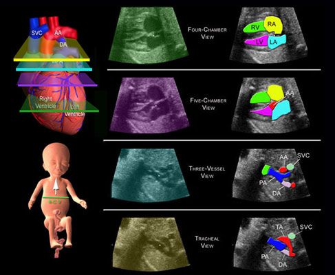 obstetric ultrasound imaging