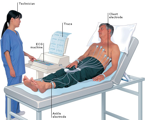 ecg machine online