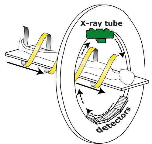 x-ray tube