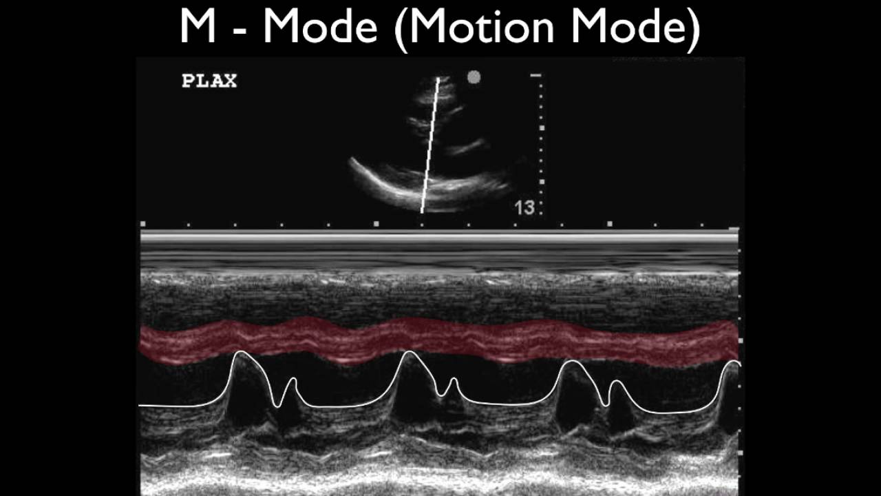 M Mode Ultrasound