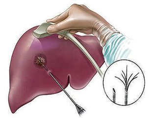 ultrasound examination