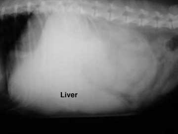 liver ultrasound