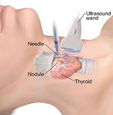 Ultrasound Scoring System