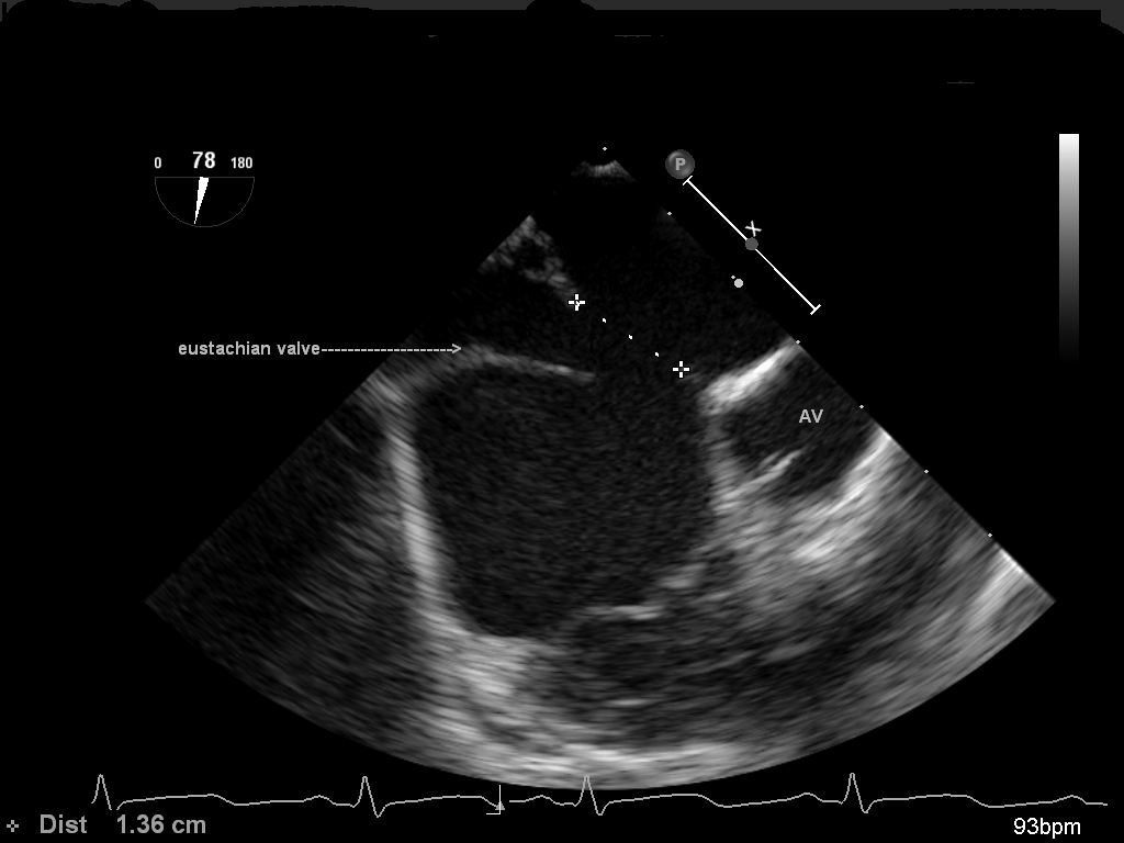 Echo imaging