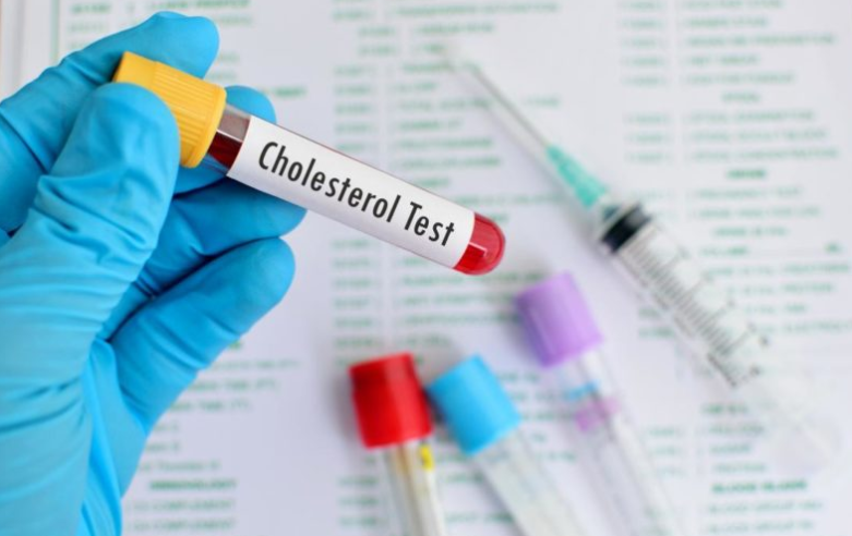 How is liver function and cholesterol production linked